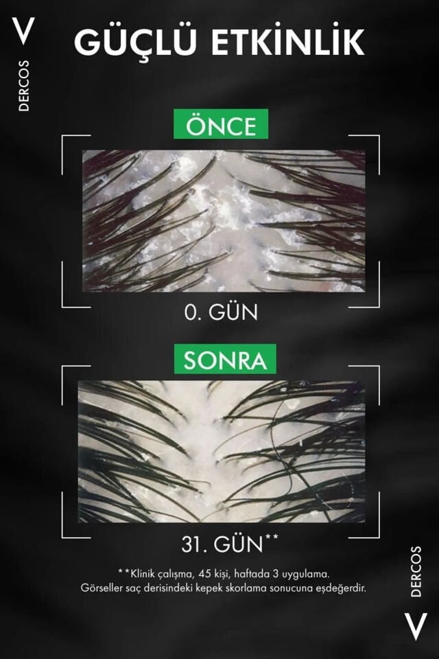 Vichy Dercos Anti Dandruff Kepek Karşıtı Şampuan 390 ml Normal ve Yağlı Saçlar