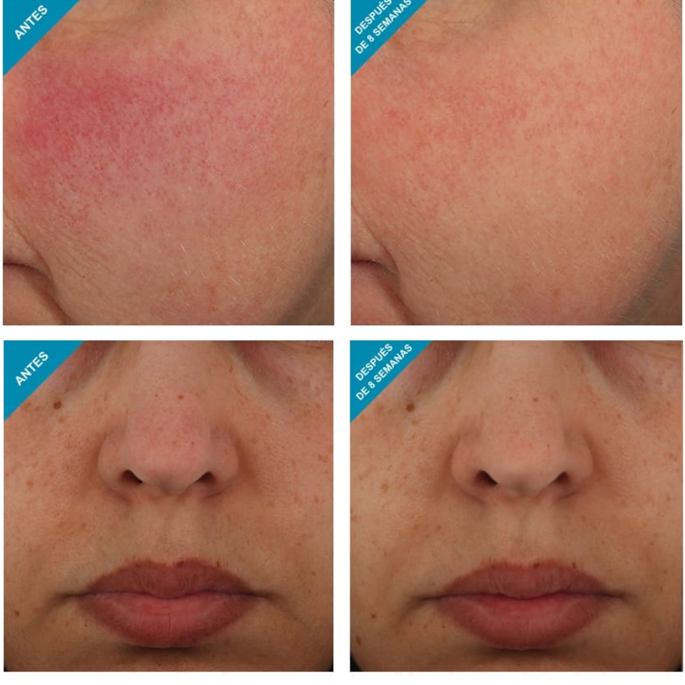 Skinceuticals Resveratrol B E 30ml